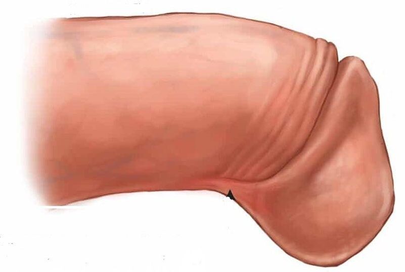 glans penisi nasıl büyütülür